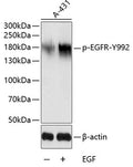 Phospho-EGFR-Y992 polyclonal antibody – Figure 1 of 2