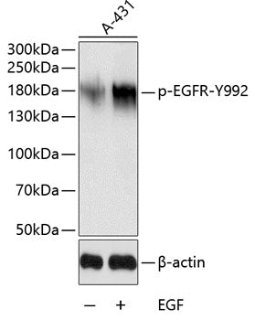 Phospho-EGFR-Y992 polyclonal antibody – Figure 1 of 2