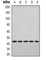 Phospho-p38 MAPK-Y182 polyclonal antibody – Figure 1 of 4