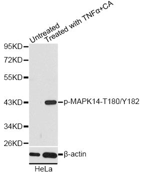 Western blot analysis of extracts of HeLa cells, using p38/MAPK14 (phospho-Y182) polyclonal antibody.