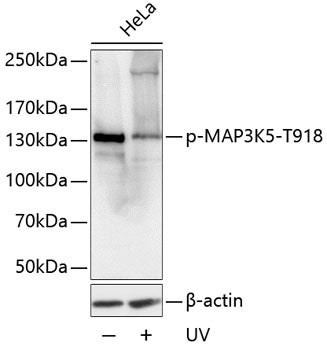 Phospho-MAP3K5-T918 polyclonal antibody – Figure 1 of 1