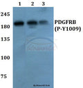 Western blot (WB) analysis of p-PDGFR-β (Y1009) polyclonal antibody at 1:500 dilution
Lane1:A549 cell lysate treated with EGF(0.1ng/ml,30mins)
Lane2:Raw264.7 cell lysate treated with EGF(0.1ng/ml,30mins)
Lane3:PC12 cell lysate treated with EGF(0.1ng/ml,30mins)