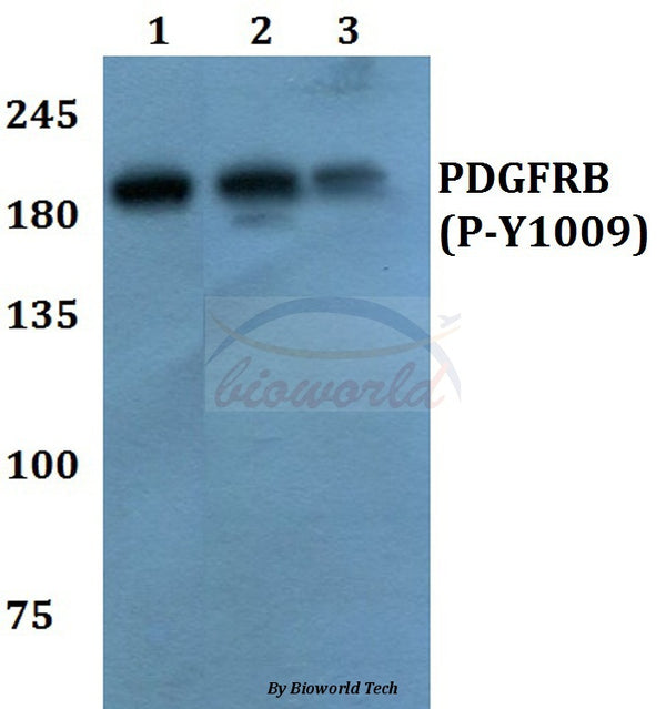 Western blot (WB) analysis of p-PDGFR-β (Y1009) polyclonal antibody at 1:500 dilution
Lane1:A549 cell lysate treated with EGF(0.1ng/ml,30mins)
Lane2:Raw264.7 cell lysate treated with EGF(0.1ng/ml,30mins)
Lane3:PC12 cell lysate treated with EGF(0.1ng/ml,30mins)