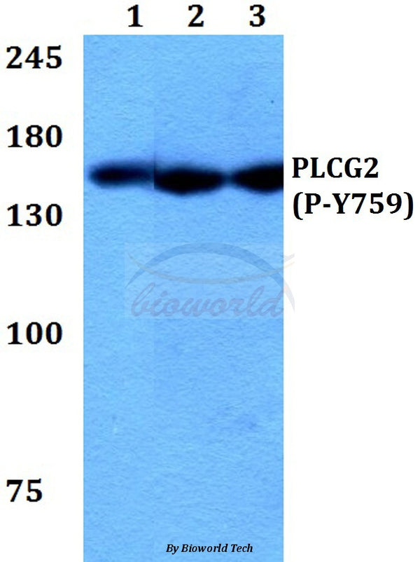 Western blot (WB) analysis of p-PLC γ2 (Y759) polyclonal antibody at 1:500 dilution
Lane1:Hela whole cell lysate 
Lane2:NIH-3T3 whole cell lysate
Lane3:H9C2 whole cell lysate