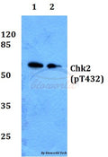 Western blot (WB) analysis of p-Chk2 (T432) polyclonal antibody at 1:500 dilution
Lane1:Jurkat whole cell lysate
Lane2:H9C2 whole cell lysate