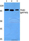 Western blot (WB) analysis of p-TLK1 (S743) polyclonal antibody at 1:500 dilution
Lane1:MCF-7 whole cell lysate
Lane2:Rat brain tissue lysate
Lane3:H9C2 whole cell lysate