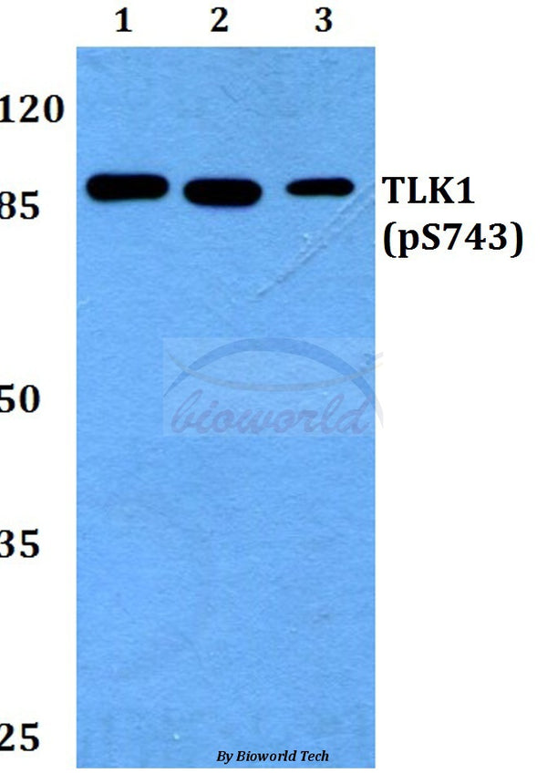 Western blot (WB) analysis of p-TLK1 (S743) polyclonal antibody at 1:500 dilution
Lane1:MCF-7 whole cell lysate
Lane2:Rat brain tissue lysate
Lane3:H9C2 whole cell lysate
