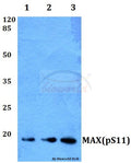 Western blot (WB) analysis of p-MAX (S11) polyclonal antibody at 1:500 dilution
Lane1:Hela whole cell lysate
Lane2:Mouse heart tissue lysate
Lane3:H9C2 whole cell lysate