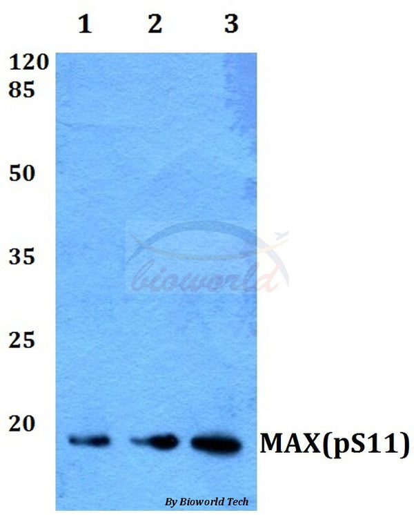 Western blot (WB) analysis of p-MAX (S11) polyclonal antibody at 1:500 dilution
Lane1:Hela whole cell lysate
Lane2:Mouse heart tissue lysate
Lane3:H9C2 whole cell lysate
