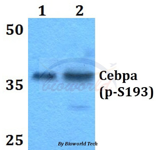 Western blot (WB) analysis of p-C/EBP α (S193) polyclonal antibody at 1:500 dilution
Lane2:Raw264.7 cell lysate treated with PMA(100nM,15mins)
Lane3:H9C2 ccell lysate treated with PMA(100nM,15mins)