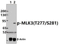 Western blot (WB) analysis of MLK3 (phospho-T277/S281) polyclonal antibody at 1:1000 dilution
Lane1:Hela treated with λ-phosphatase whole cell lysate(30ug)
Lane2:Hela whole cell lysate(30ug)