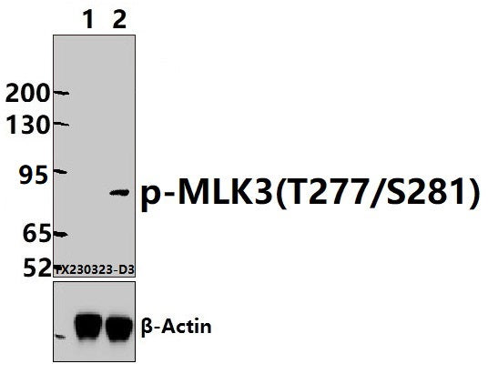 Western blot (WB) analysis of MLK3 (phospho-T277/S281) polyclonal antibody at 1:1000 dilution
Lane1:Hela treated with λ-phosphatase whole cell lysate(30ug)
Lane2:Hela whole cell lysate(30ug)