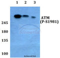Western blot (WB) analysis of p-ATM (S1981) polyclonal antibody at 1:500 dilution
Lane1:Hela whole cell lysate treated with colchicine(0.2ng/ml,24h)
Lane2:Raw264.7 whole cell lysate treated with colchicine(0.2ng/ml,24h)
Lane3:H9C2 whole cell lysate treated with colchicine(0.2ng/ml,24h)