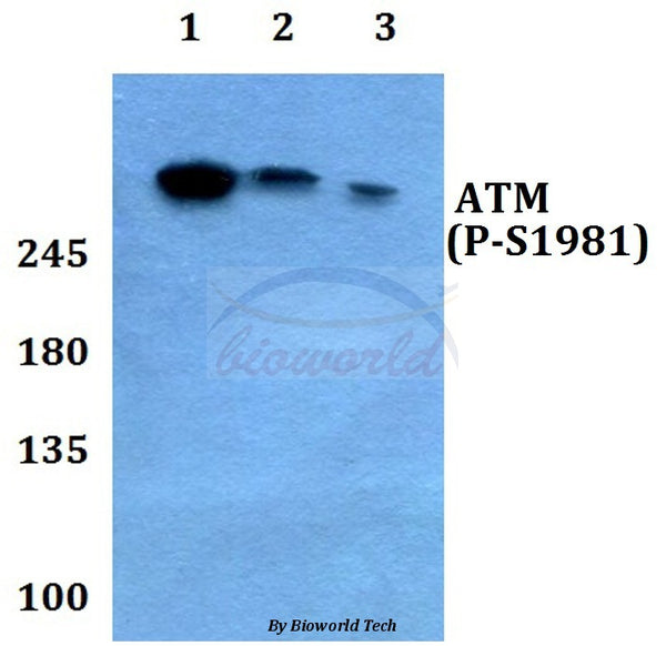 Western blot (WB) analysis of p-ATM (S1981) polyclonal antibody at 1:500 dilution
Lane1:Hela whole cell lysate treated with colchicine(0.2ng/ml,24h)
Lane2:Raw264.7 whole cell lysate treated with colchicine(0.2ng/ml,24h)
Lane3:H9C2 whole cell lysate treated with colchicine(0.2ng/ml,24h)
