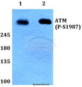 Western blot (WB) analysis of p-ATM (S1987) polyclonal antibody at 1:500 dilution
Lane1:HEK293T whole cell lysate treated with UV(24h)
Lane2:Raw264.7 whole cell lysate treated with UV(24h)