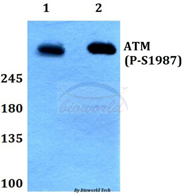 Western blot (WB) analysis of p-ATM (S1987) polyclonal antibody at 1:500 dilution
Lane1:HEK293T whole cell lysate treated with UV(24h)
Lane2:Raw264.7 whole cell lysate treated with UV(24h)