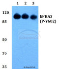 Western blot (WB) analysis of p-EphA3 (Y602) polyclonal antibody at 1:500 dilution
Lane1:HEK293Twhole cell lysate
Lane2:sp2/0 whole cell lysate
Lane3:H9C2 whole cell lysate
