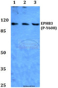 Western blot (WB) analysis of p-EphB3 (Y608) polyclonal antibody at 1:500 dilution
Lane1:Hela whole cell lysate
Lane2:NIH-3T3 whole cell lysate
Lane3:PC12 whole cell lysate
