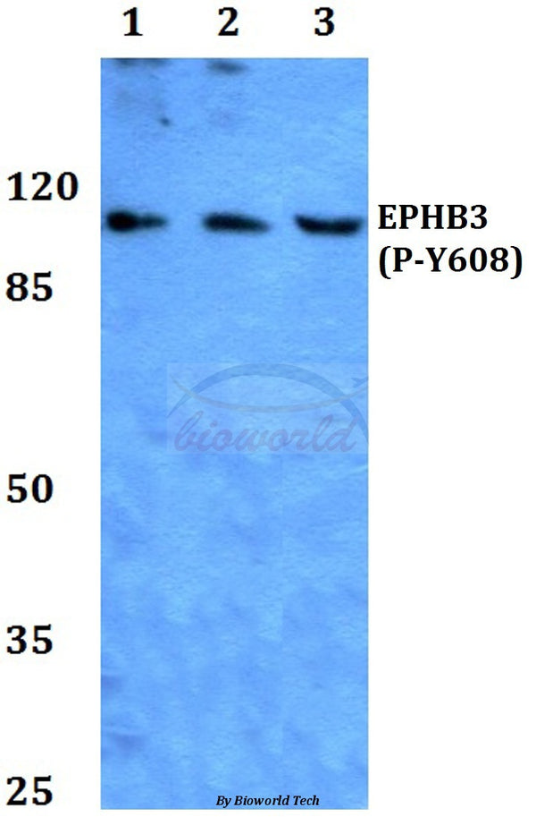 Western blot (WB) analysis of p-EphB3 (Y608) polyclonal antibody at 1:500 dilution
Lane1:Hela whole cell lysate
Lane2:NIH-3T3 whole cell lysate
Lane3:PC12 whole cell lysate