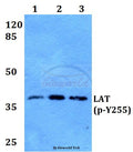 Western blot (WB) analysis of p-LAT (Y255) polyclonal antibody at 1:500 dilution
Lane1:HEK293T whole cell lysate
Lane2:Raw264.7 whole cell lysate
Lane3:H9C2 whole cell lysate