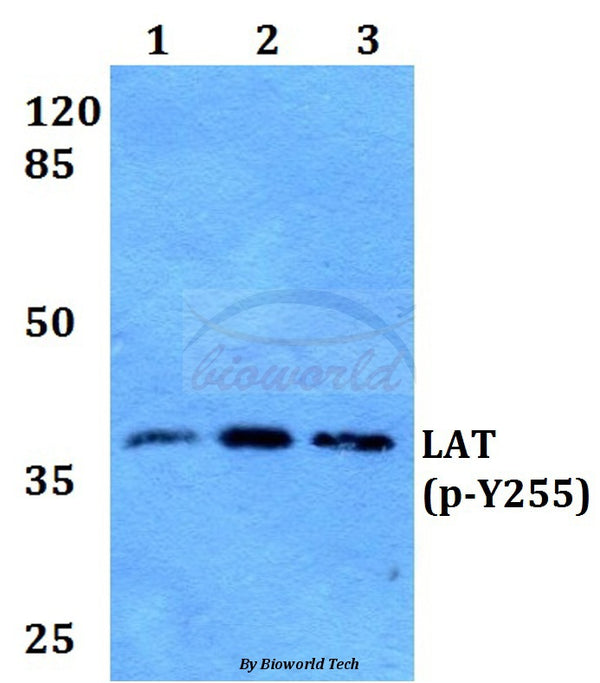 Western blot (WB) analysis of p-LAT (Y255) polyclonal antibody at 1:500 dilution
Lane1:HEK293T whole cell lysate
Lane2:Raw264.7 whole cell lysate
Lane3:H9C2 whole cell lysate