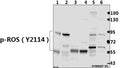 Western blot (WB) analysis of p-ROS（Y2114) pAb at 1:500 dilution
Lane1:C6 whole cell lysate(40ug)
Lane2:Hela whole cell lysate(40ug)
Lane3:The Brain tissue lysate of Mouse(40ug)
Lane4:The Brain tissue lysate of Rat(40ug)  
Lane5:HEK293T whole cell lysate(40ug)
Lane6:A549 whole cell lysate(40ug)