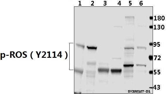 Western blot (WB) analysis of p-ROS（Y2114) pAb at 1:500 dilution
Lane1:C6 whole cell lysate(40ug)
Lane2:Hela whole cell lysate(40ug)
Lane3:The Brain tissue lysate of Mouse(40ug)
Lane4:The Brain tissue lysate of Rat(40ug)  
Lane5:HEK293T whole cell lysate(40ug)
Lane6:A549 whole cell lysate(40ug)
