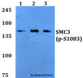 Western blot (WB) analysis of p-SMC3 (S1083) polyclonal antibody at 1:500 dilution
Lane1:A549 whole cell lysate
Lane2:sp2/0 whole cell lysate 
Lane3:PC12 whole cell lysate