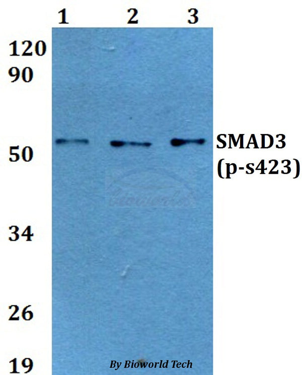 Western blot (WB) analysis of p-SMAD3 (S423) polyclonal antibody at 1:500 dilution
Lane1:Hela cell lysate treated with EGF(0.1ng/ML,30mins)
Lane2:Raw264.7 cell lysate treated with EGF(0.1ng/ML,30mins) 
Lane3:H9C2 cell lysate treated with EGF(0.1ng/ML,30mins)