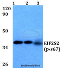 Western blot (WB) analysis of p-EIF2S2 (S67) polyclonal antibody at 1:500 dilution
Lane1:A549 whole cell lysate
Lane2:sp2/0 whole cell lysate 
Lane3:PC12 whole cell lysate