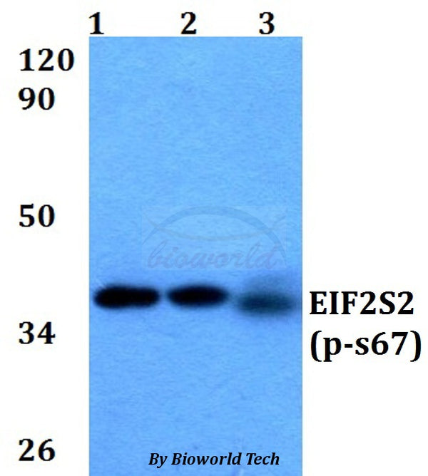 Western blot (WB) analysis of p-EIF2S2 (S67) polyclonal antibody at 1:500 dilution
Lane1:A549 whole cell lysate
Lane2:sp2/0 whole cell lysate 
Lane3:PC12 whole cell lysate