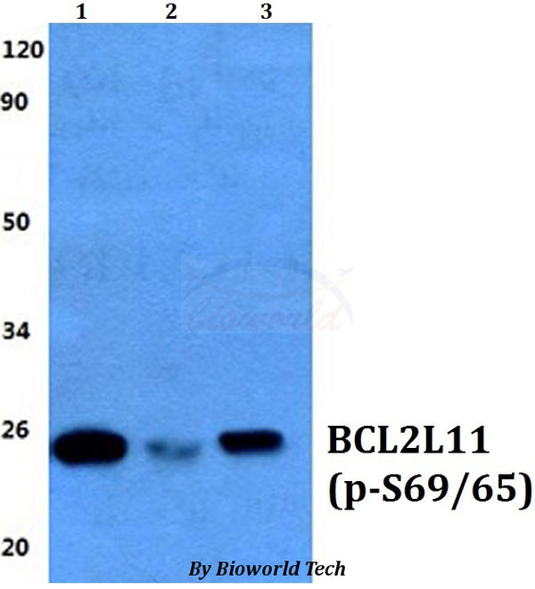Western blot (WB) analysis of p-Bim (S69/S65) polyclonal antibody at 1:500 dilution
Lane1:HEK293T whole cell lysate
Lane2:Raw264.7 whole cell lysate
Lane3:sp2/0 whole cell lysate