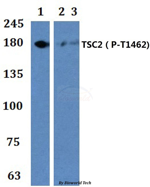 Western blot (WB) analysis of p-TSC2 (T1462) polyclonal antibody at 1:500 dilution
Lane1:HEK293T cell lysate Insulin (30ng/ml,5min)
Lane2:H9C2 cell lysateEGF (20ng/ml,30min)
Lane3:Raw264.7 cell lysate EGF (20ng/ml,30min)
