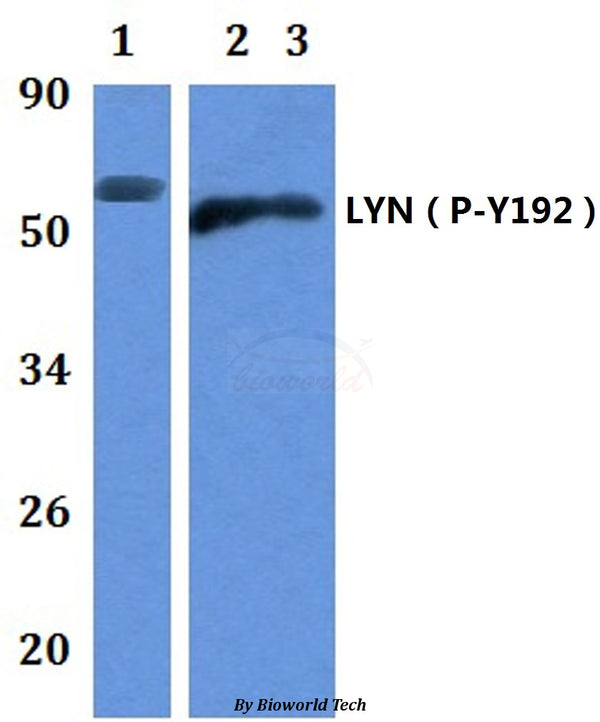 Western blot (WB) analysis of p-LYN (Y192) polyclonal antibody at 1:500 dilution
Lane1:MCF-7 whole cell lysate
Lane2:The Brain tissue lysate of Mouse
Lane3:The Brain tissue lysate of Rat