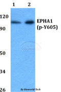 Western blot (WB) analysis of p-EPHA1 (Y605) polyclonal antibody at 1:500 dilution
Lane1:A549 whole cell lysate
Lane2:PC12 whole cell lysate