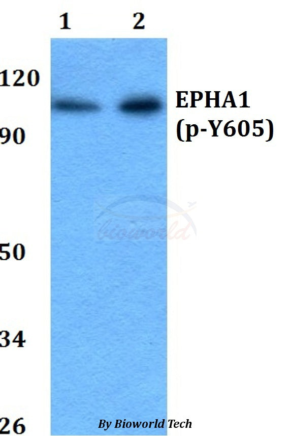 Western blot (WB) analysis of p-EPHA1 (Y605) polyclonal antibody at 1:500 dilution
Lane1:A549 whole cell lysate
Lane2:PC12 whole cell lysate