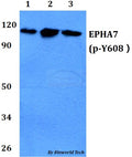 Western blot (WB) analysis of p-EPHA7(Y608) polyclonal antibody at 1:500 dilution
Lane1:A549 whole cell lysate
Lane2:sp2/0 whole cell lysate 
Lane3:PC12 whole cell lysate