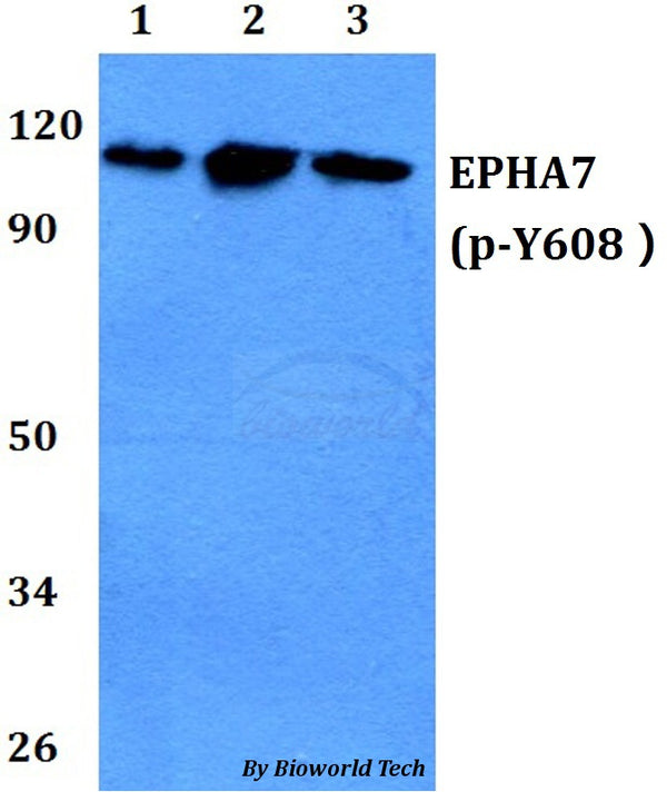 Western blot (WB) analysis of p-EPHA7(Y608) polyclonal antibody at 1:500 dilution
Lane1:A549 whole cell lysate
Lane2:sp2/0 whole cell lysate 
Lane3:PC12 whole cell lysate