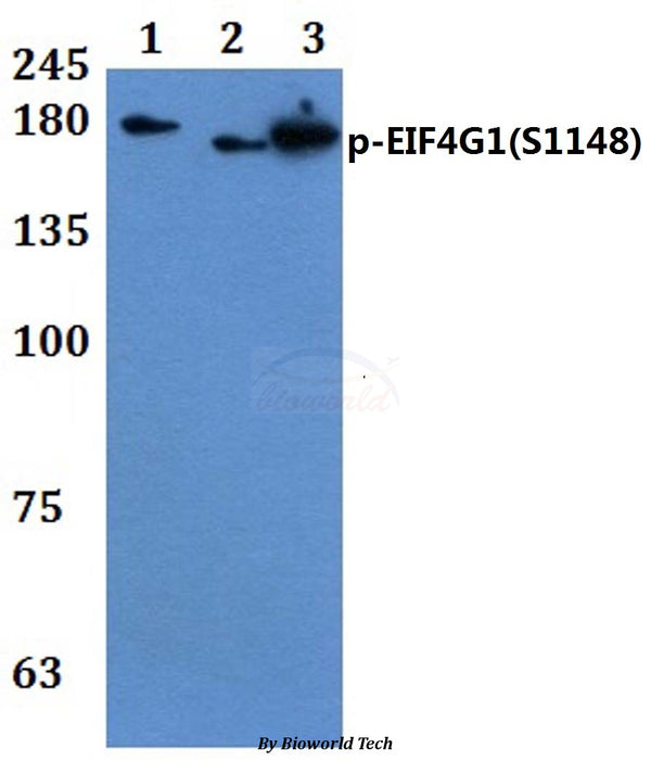 Western blot (WB) analysis of p-EIF4G1(S1148) polyclonal antibody at 1:500 dilution  Lane1:THP-1 treated with EGF(0.1ng/m) 30 min whole cell lysate
Lane2:PC12 treated with EGF(0.1ng/m) 30 min whole cell lysate
Lane3:Raw264.7 treated with EGF(0.1ng/m) 30 min whole cell lysate