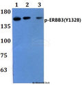 Western blot (WB) analysis of p-ERBB3(Y1328) polyclonal antibody pAb at 1:500 dilution  
Lane1:MCF-7 treated with EGF(0.1ng/m) 30 min whole cell lysate
Lane2:THP-1 treated with EGF(0.1ng/m) 30 min whole cell lysate
Lane3:Raw264.7 treated with EGF(0.1ng/m) 30 min whole cell lysate