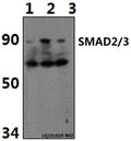 Western blot (WB) analysis of SMAD2/3 (Acetyl-K19) polyclonal antibody at 1:500 dilution
Lane1:PC12 whole cell lysate(40ug)
Lane2:NIH-3T3 whole cell lysate(40ug)
Lane3:Hela whole cell lysate(40ug)