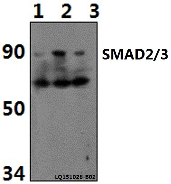 Western blot (WB) analysis of SMAD2/3 (Acetyl-K19) polyclonal antibody at 1:500 dilution
Lane1:PC12 whole cell lysate(40ug)
Lane2:NIH-3T3 whole cell lysate(40ug)
Lane3:Hela whole cell lysate(40ug)