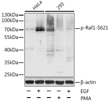 Phospho-Raf1-S621 polyclonal antibody – Figure 1 of 3