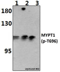 Western blot (WB) analysis of p-MYPT1 (T696) polyclonal antibody at 1:500 dilution
Lane1:HEK293T whole cell lysate(40ug)
Lane2:HEK293T treated with PMA (60ng/ml, 10min) whole cell lysate (40ug)
Lane3:HEK293T treated with UV (4h) whole cell lysate (40ug)