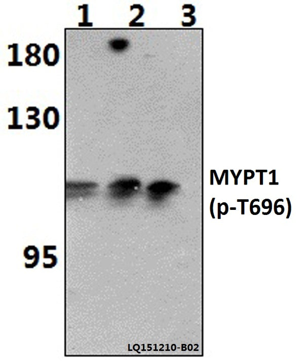 Western blot (WB) analysis of p-MYPT1 (T696) polyclonal antibody at 1:500 dilution
Lane1:HEK293T whole cell lysate(40ug)
Lane2:HEK293T treated with PMA (60ng/ml, 10min) whole cell lysate (40ug)
Lane3:HEK293T treated with UV (4h) whole cell lysate (40ug)