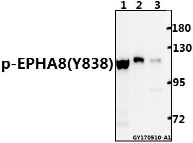 Western blot (WB) analysis of EPHA8 (phospho-Y838)  polyclonal antibody at 1:500 dilution
Lane1:Hela whole cell lysate(40ug)
Lane2:The Spleen tissue lysate of Mouse(40ug)
Lane3:The Kidney tissue lysate of Rat(40ug)