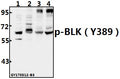 Western blot (WB) analysis of BLK (phospho-Y389) polyclonal antibody at 1:500 dilution
Lane1:COS-7whole cell lysate(40ug)
Lane2:MCF-7whole cell lysate(40ug)
Lane3:CT26 whole cell lysate(40ug)
Lane4:PC12 whole cell lysate(40ug)