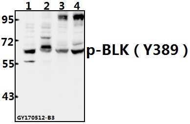 Western blot (WB) analysis of BLK (phospho-Y389) polyclonal antibody at 1:500 dilution
Lane1:COS-7whole cell lysate(40ug)
Lane2:MCF-7whole cell lysate(40ug)
Lane3:CT26 whole cell lysate(40ug)
Lane4:PC12 whole cell lysate(40ug)
