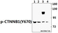 Western blot (WB) analysis Catenin-β (phospho-Y670) polyclonal antibody at 1:500 dilution
Lane1:L02 whole cell lysate(40ug)
Lane2:HepG2 whole cell lysate(40ug)
Lane3:AML-12 whole cell lysate(40ug)
Lane4:PC12 whole cell lysate(40ug)