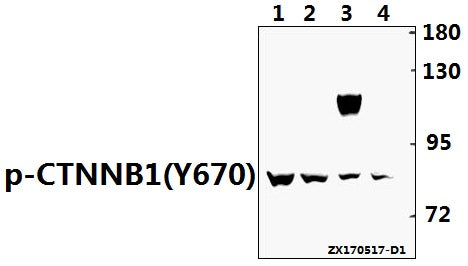 Western blot (WB) analysis Catenin-β (phospho-Y670) polyclonal antibody at 1:500 dilution
Lane1:L02 whole cell lysate(40ug)
Lane2:HepG2 whole cell lysate(40ug)
Lane3:AML-12 whole cell lysate(40ug)
Lane4:PC12 whole cell lysate(40ug)